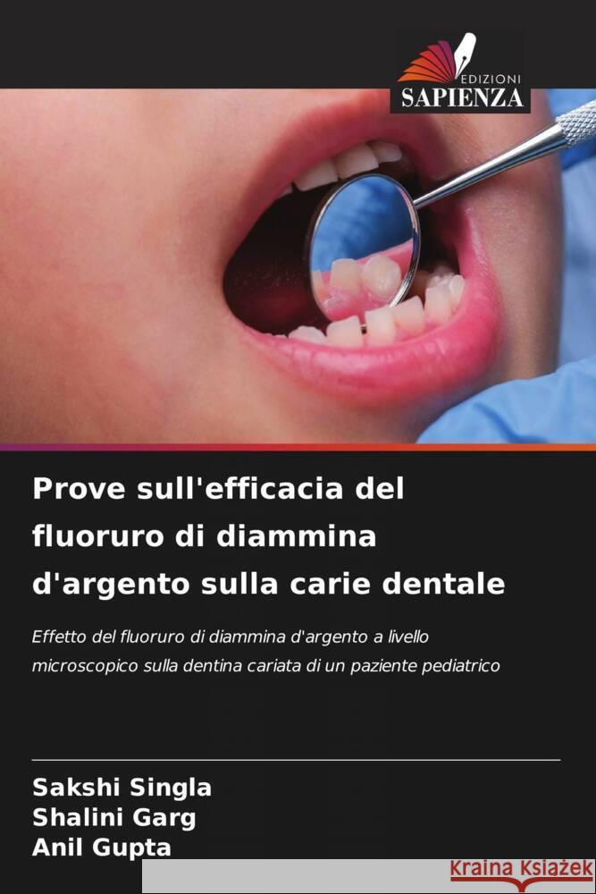 Prove sull'efficacia del fluoruro di diammina d'argento sulla carie dentale Sakshi Singla Shalini Garg Anil Gupta 9786208153748