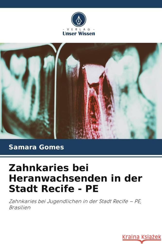 Zahnkaries bei Heranwachsenden in der Stadt Recife - PE Samara Gomes 9786208163877