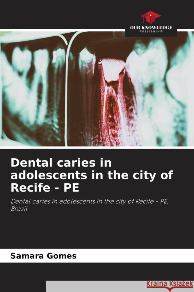 Dental caries in adolescents in the city of Recife - PE Samara Gomes 9786208163884