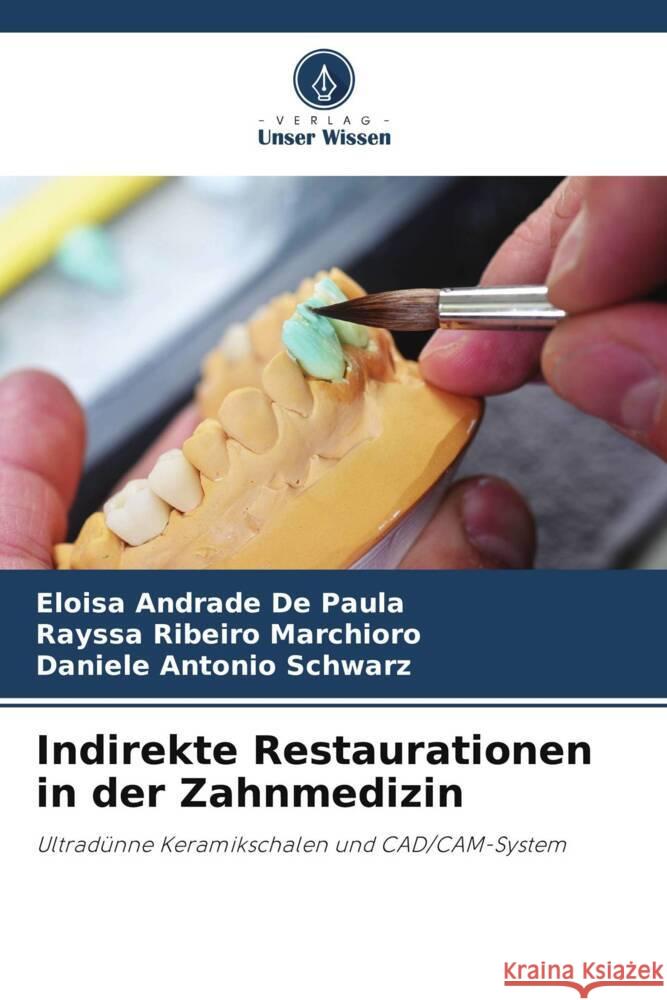 Indirekte Restaurationen in der Zahnmedizin Andrade De Paula, Eloisa, Ribeiro Marchioro, Rayssa, Antonio Schwarz, Daniele 9786208165734