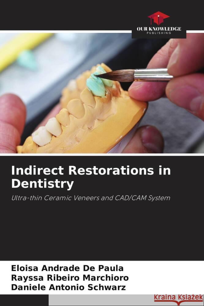 Indirect Restorations in Dentistry Andrade De Paula, Eloisa, Ribeiro Marchioro, Rayssa, Antonio Schwarz, Daniele 9786208165741