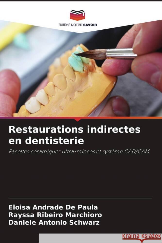 Restaurations indirectes en dentisterie Andrade De Paula, Eloisa, Ribeiro Marchioro, Rayssa, Antonio Schwarz, Daniele 9786208165772