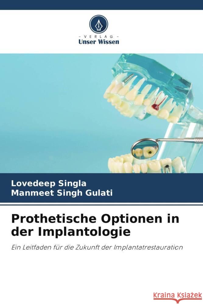 Prothetische Optionen in der Implantologie Lovedeep Singla Manmeet Singh Gulati 9786208168735