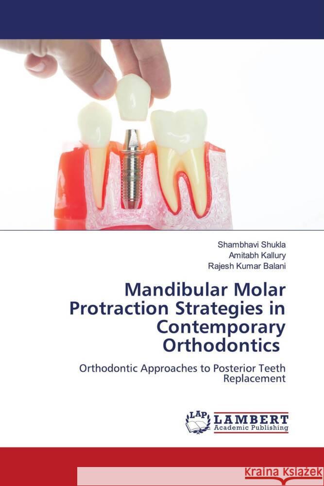 Mandibular Molar Protraction Strategies in Contemporary Orthodontics Shambhavi Shukla Amitabh Kallury Rajesh Kuma 9786208170837