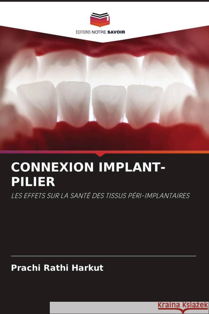 CONNEXION IMPLANT-PILIER Rathi Harkut, Prachi 9786208174293