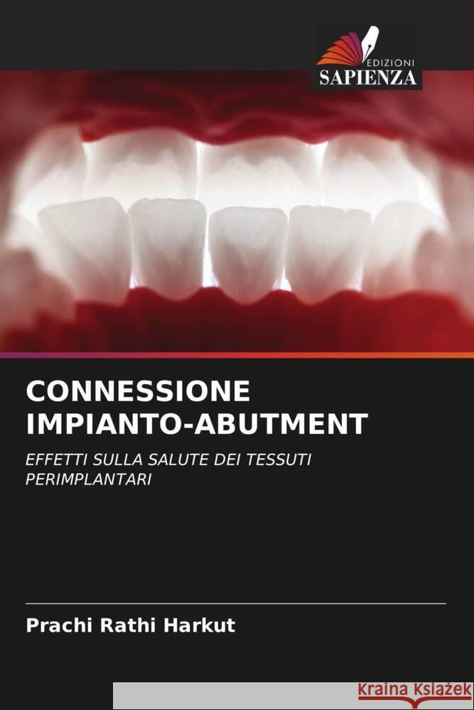 CONNESSIONE IMPIANTO-ABUTMENT Rathi Harkut, Prachi 9786208174309