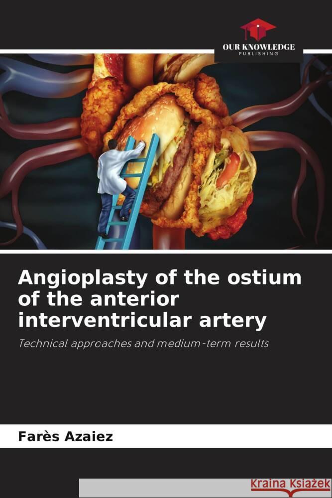 Angioplasty of the ostium of the anterior interventricular artery Azaiez, Farès 9786208177270