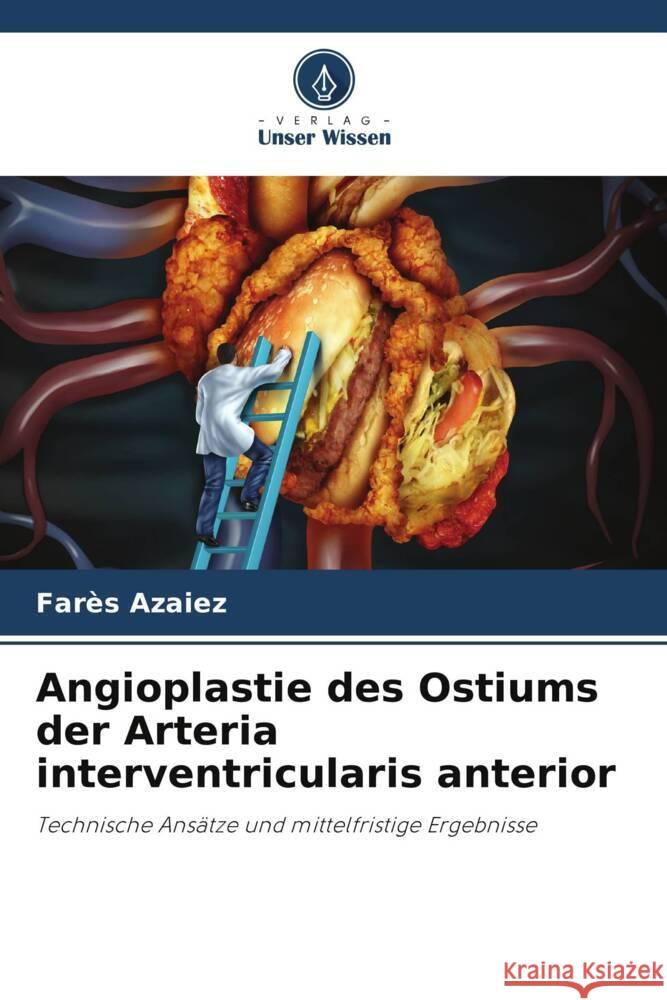 Angioplastie des Ostiums der Arteria interventricularis anterior Azaiez, Farès 9786208177287 Verlag Unser Wissen