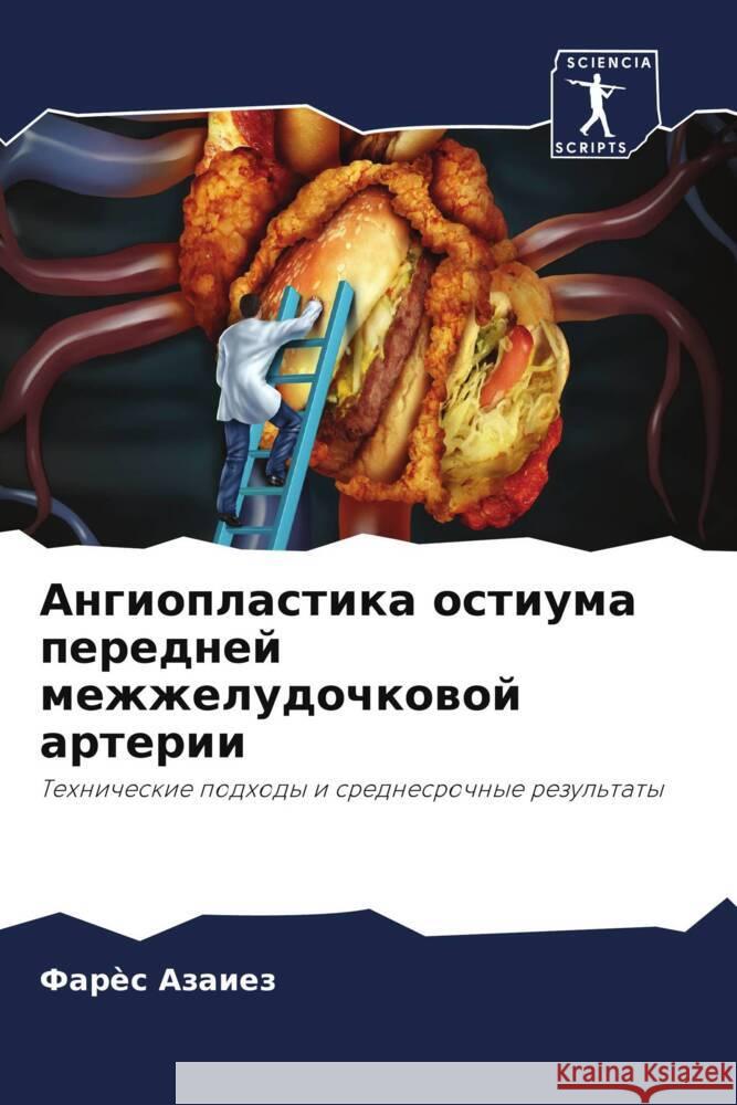 Angioplastika ostiuma perednej mezhzheludochkowoj arterii Azaiez, Farès 9786208177317