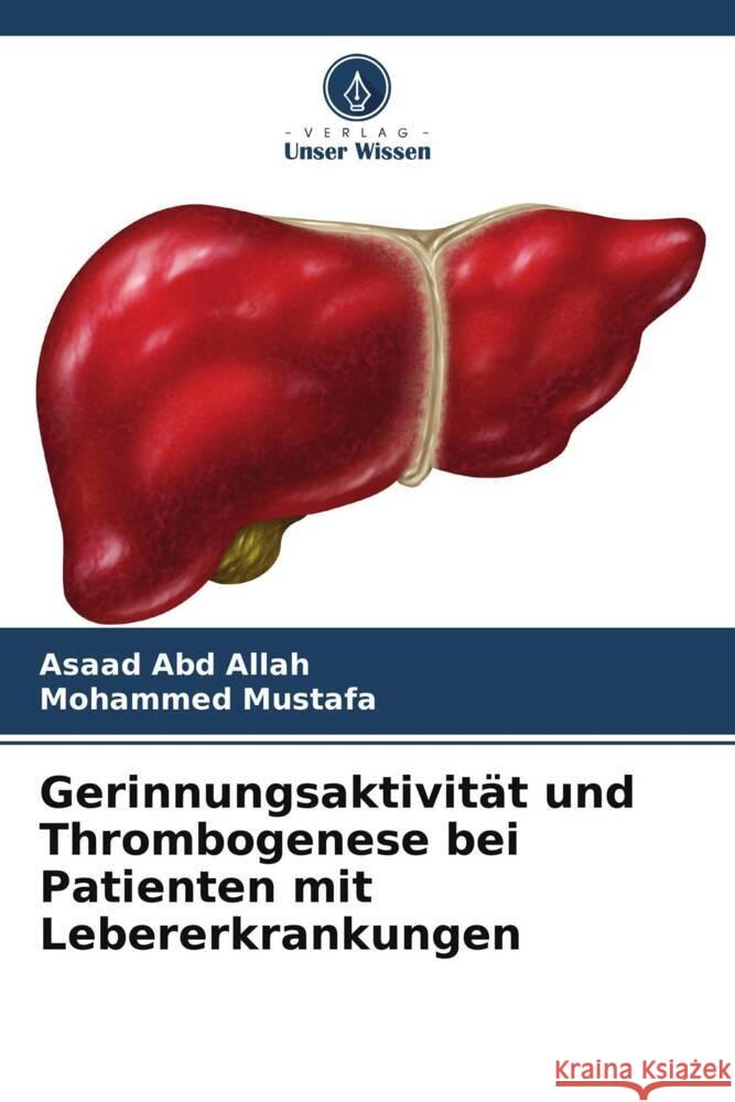 Gerinnungsaktivität und Thrombogenese bei Patienten mit Lebererkrankungen Abd Allah, Asaad, Mustafa, Mohammed 9786208183141 Verlag Unser Wissen