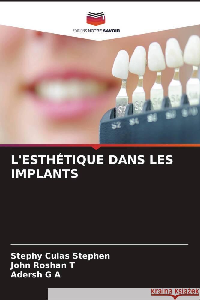 L'ESTHÉTIQUE DANS LES IMPLANTS Stephen, Stephy Culas, Roshan T, John, G A, Adersh 9786208190231