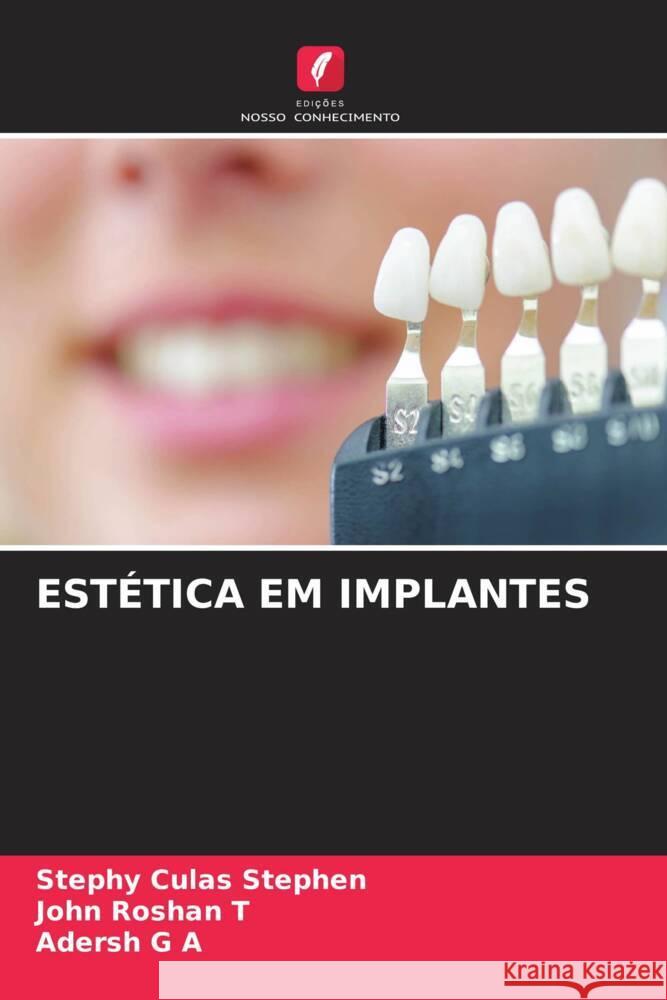 ESTÉTICA EM IMPLANTES Stephen, Stephy Culas, Roshan T, John, G A, Adersh 9786208190316