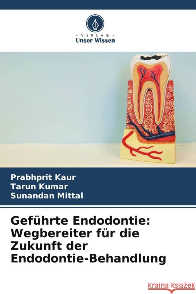 Geführte Endodontie: Wegbereiter für die Zukunft der Endodontie-Behandlung Kaur, Prabhprit, Kumar, Tarun, Mittal, Sunandan 9786208192693