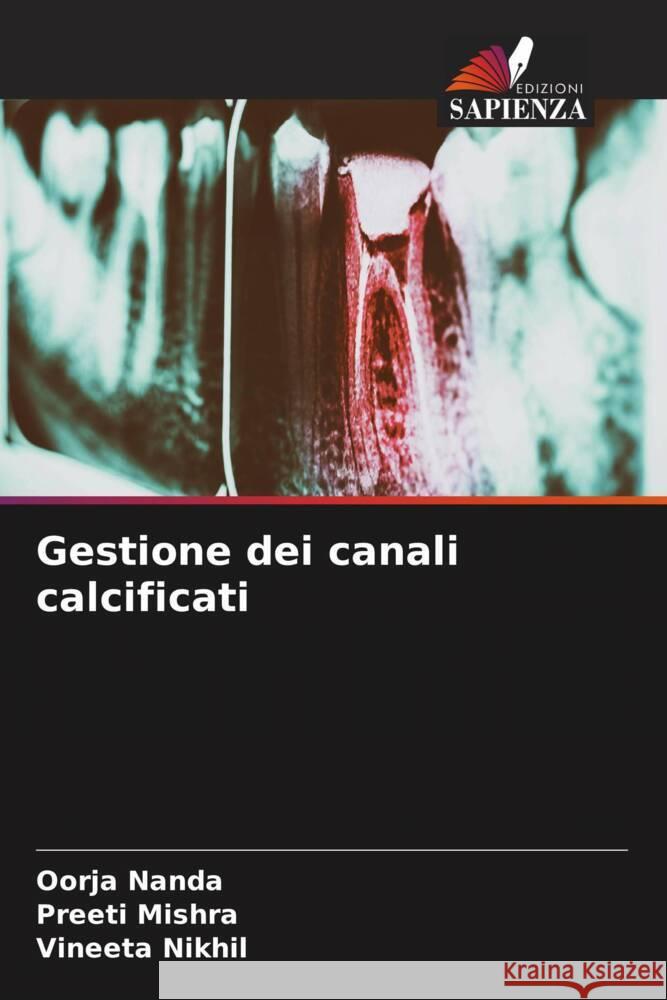 Gestione dei canali calcificati Nanda, Oorja, Mishra, Preeti, Nikhil, Vineeta 9786208197520