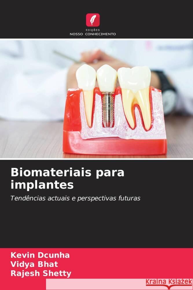 Biomateriais para implantes Dcunha, Kevin, Bhat, Vidya, Shetty, Rajesh 9786208198053