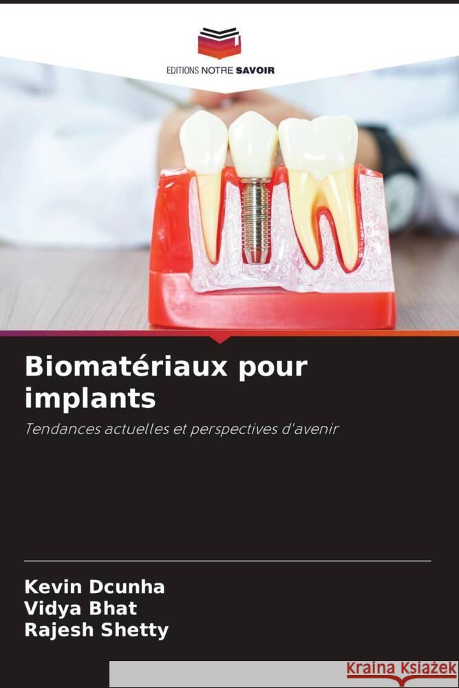 Biomatériaux pour implants Dcunha, Kevin, Bhat, Vidya, Shetty, Rajesh 9786208198107