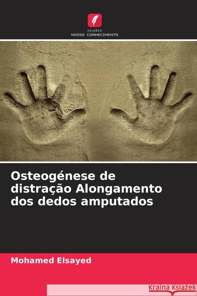 Osteogénese de distração Alongamento dos dedos amputados Elsayed, Mohamed 9786208199135