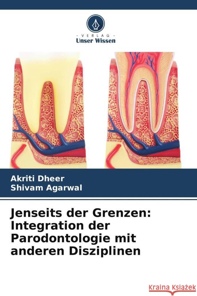 Jenseits der Grenzen: Integration der Parodontologie mit anderen Disziplinen Dheer, Akriti, Agarwal, Shivam 9786208203191