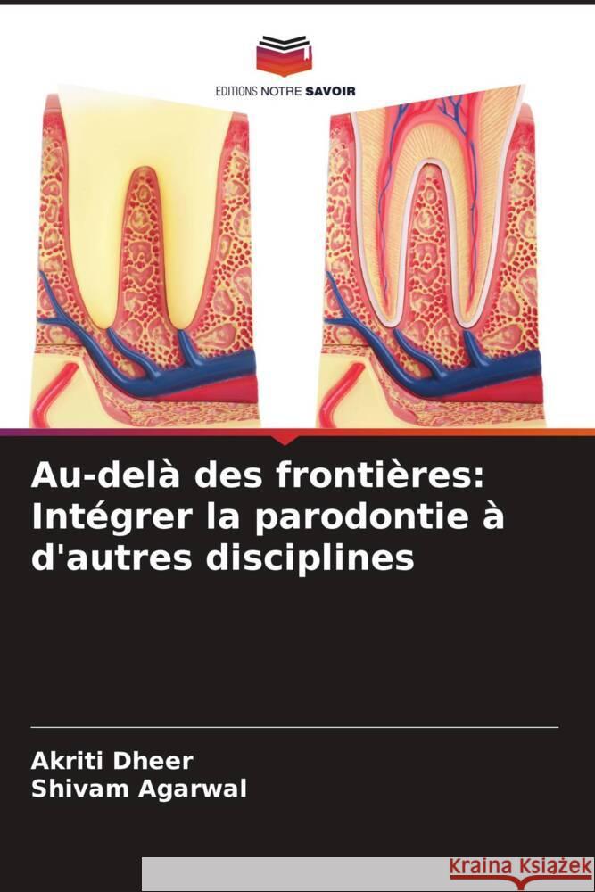 Au-delà des frontières: Intégrer la parodontie à d'autres disciplines Dheer, Akriti, Agarwal, Shivam 9786208203214