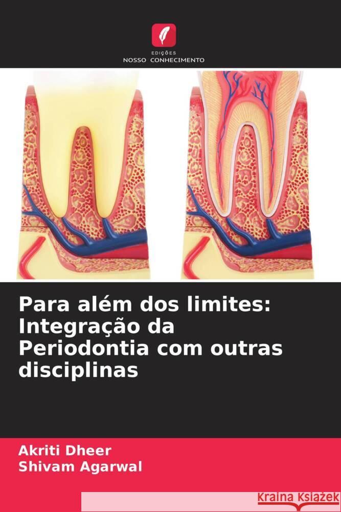 Para além dos limites: Integração da Periodontia com outras disciplinas Dheer, Akriti, Agarwal, Shivam 9786208203238