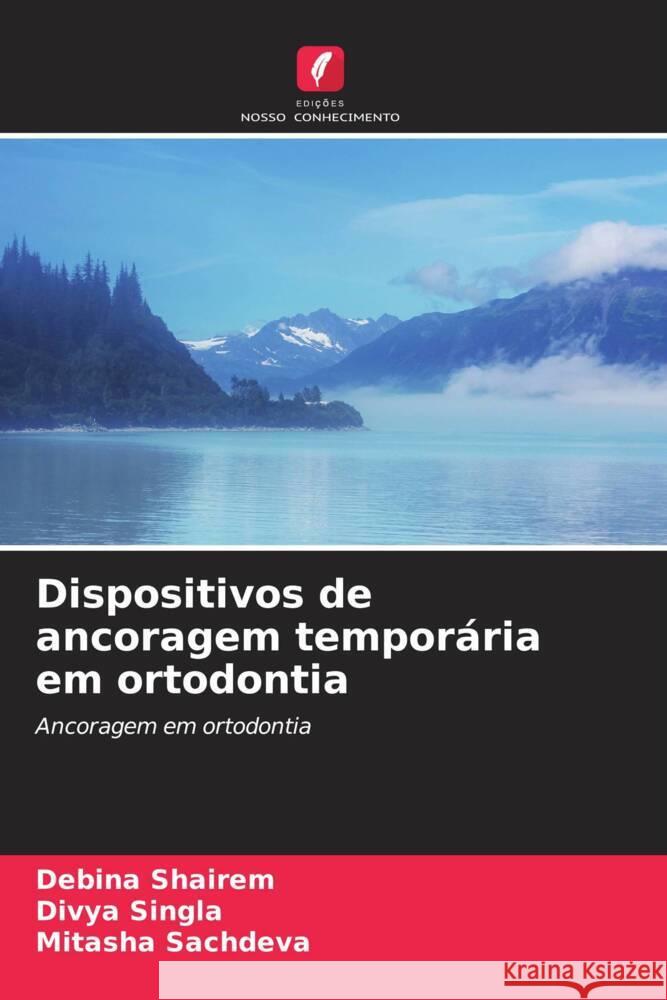 Dispositivos de ancoragem temporária em ortodontia Shairem, Debina, Singla, Divya, Sachdeva, Mitasha 9786208210861