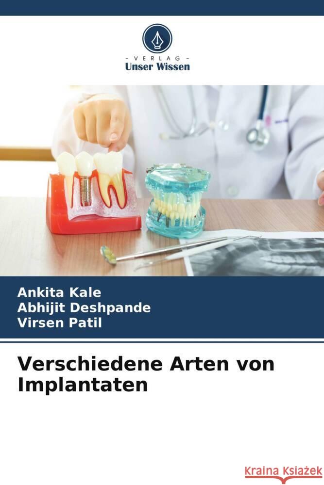 Verschiedene Arten von Implantaten Kale, Ankita, Deshpande, Abhijit, Patil, Virsen 9786208212063