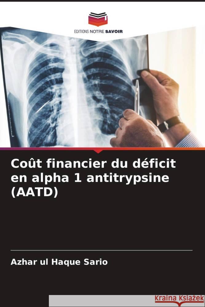 Co?t financier du d?ficit en alpha 1 antitrypsine (AATD) Azhar Ul Haque Sario 9786208219635 Editions Notre Savoir