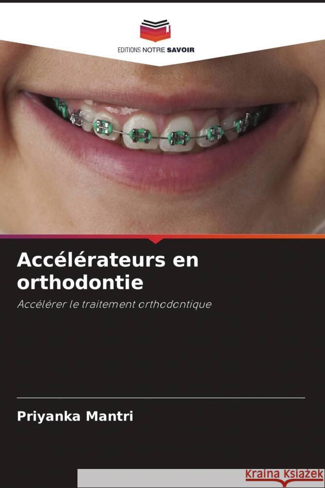 Acc?l?rateurs en orthodontie Priyanka Mantri 9786208227586 Editions Notre Savoir