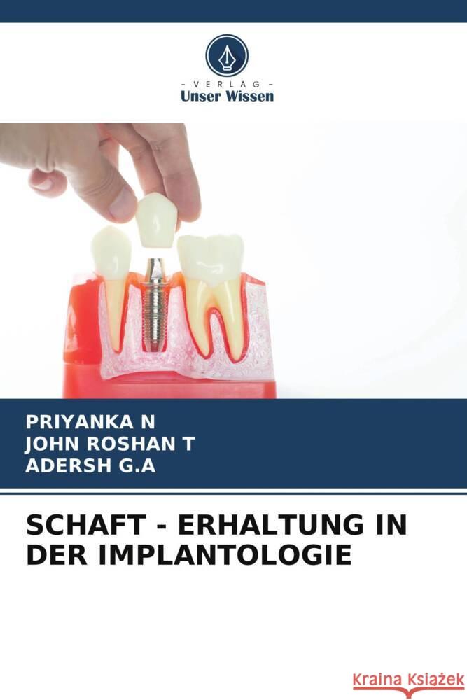 SCHAFT - ERHALTUNG IN DER IMPLANTOLOGIE N, PRIYANKA, Roshan T, John, G.A, Adersh 9786208230791