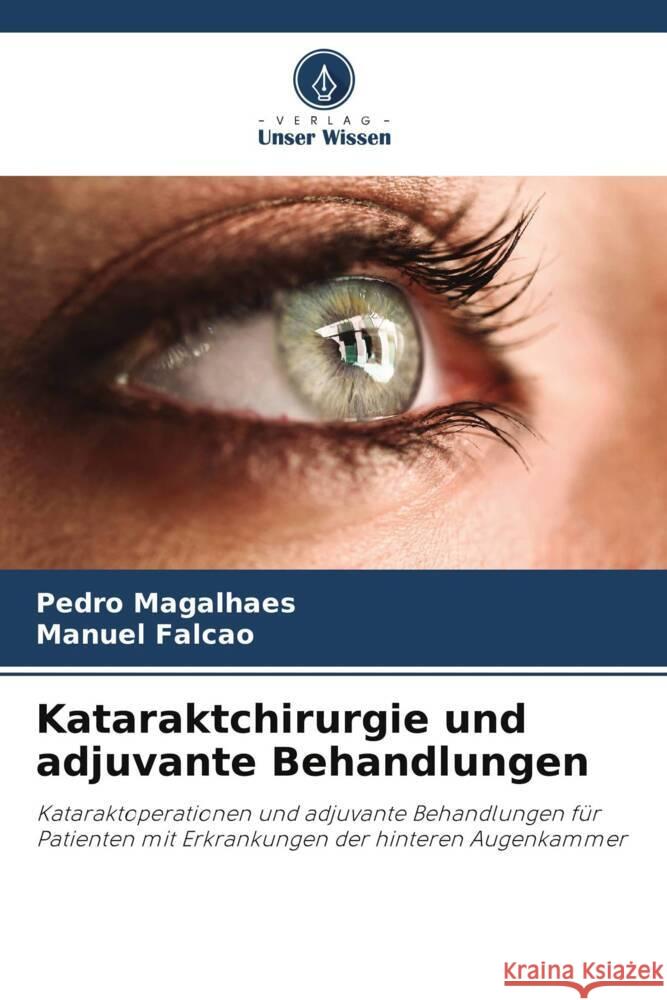 Kataraktchirurgie und adjuvante Behandlungen Magalhaes, Pedro, Falcão, Manuel 9786208234836