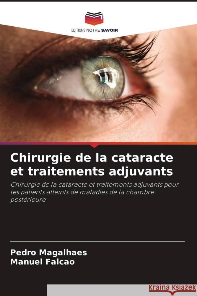 Chirurgie de la cataracte et traitements adjuvants Magalhaes, Pedro, Falcão, Manuel 9786208234843