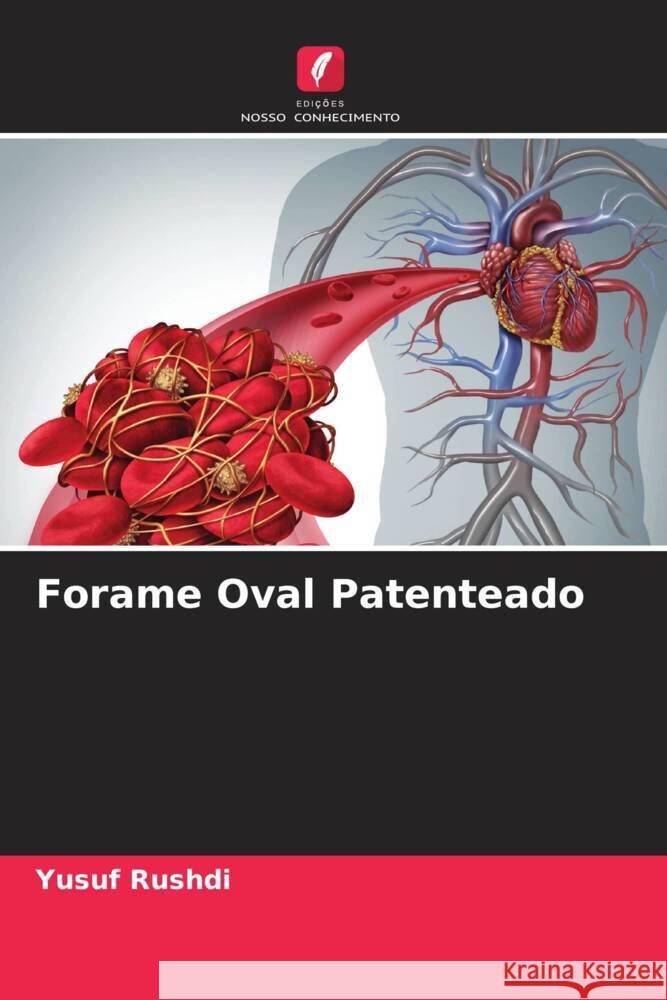 Forame Oval Patenteado Rushdi, Yusuf 9786208238599