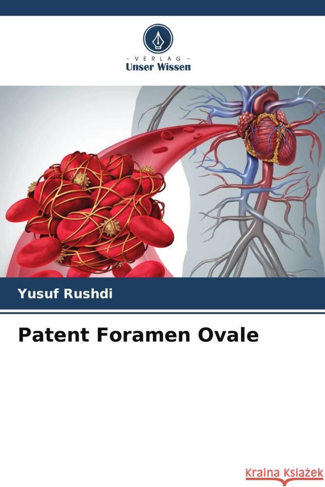 Patent Foramen Ovale Rushdi, Yusuf 9786208238636