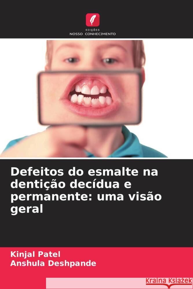 Defeitos do esmalte na dentição decídua e permanente: uma visão geral Patel, Kinjal, Deshpande, Anshula 9786208239077 Edições Nosso Conhecimento