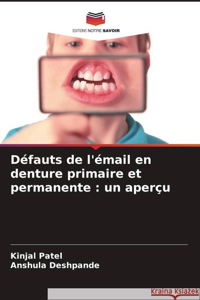 Défauts de l'émail en denture primaire et permanente : un aperçu Patel, Kinjal, Deshpande, Anshula 9786208239091