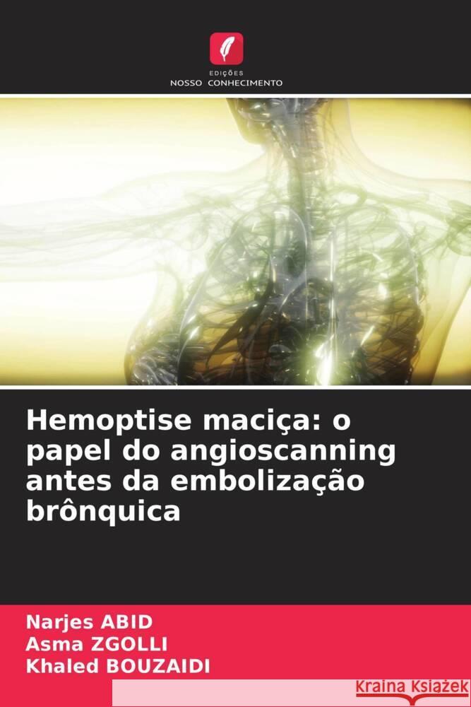 Hemoptise maciça: o papel do angioscanning antes da embolização brônquica Abid, Narjes, Zgolli, Asma, Bouzaidi, Khaled 9786208242992