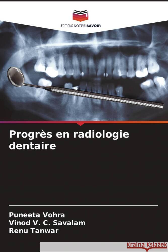 Progrès en radiologie dentaire Vohra, Puneeta, V. C. Savalam, Vinod, Tanwar, Renu 9786208243623