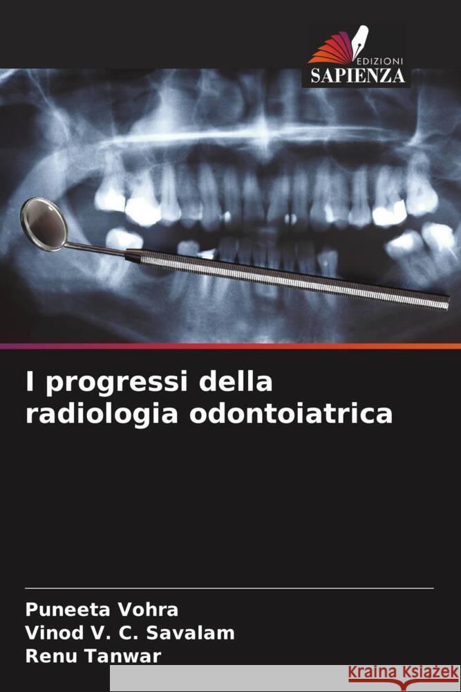 I progressi della radiologia odontoiatrica Vohra, Puneeta, V. C. Savalam, Vinod, Tanwar, Renu 9786208243630