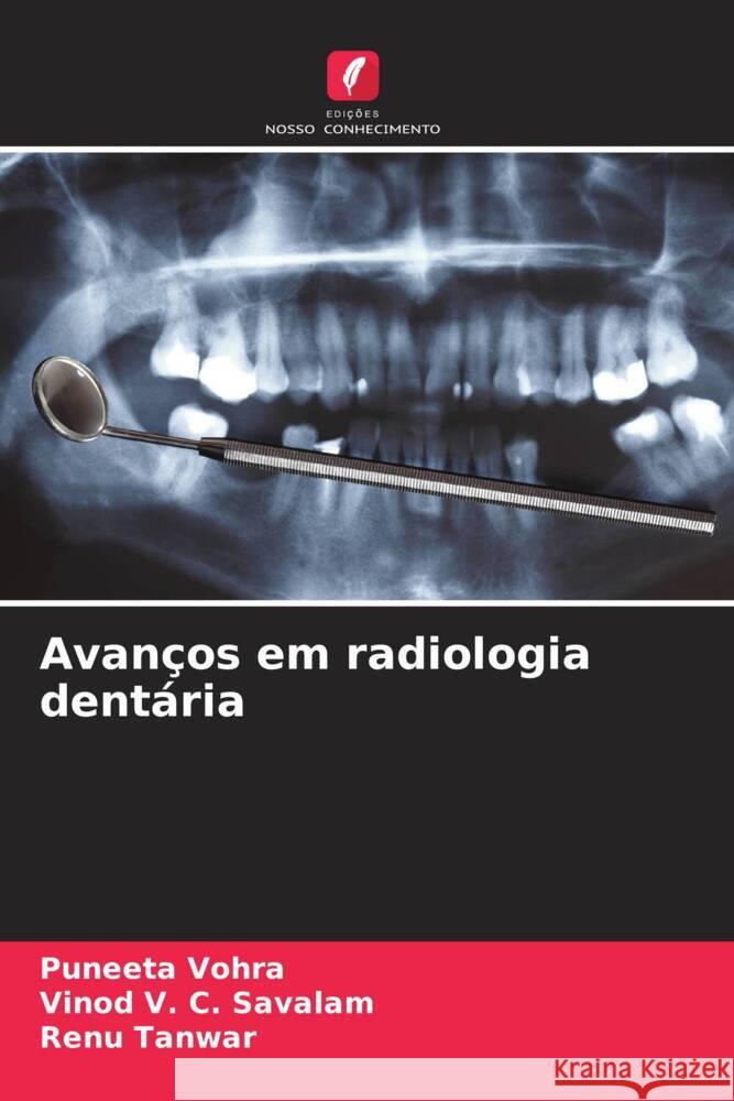 Avanços em radiologia dentária Vohra, Puneeta, V. C. Savalam, Vinod, Tanwar, Renu 9786208243647