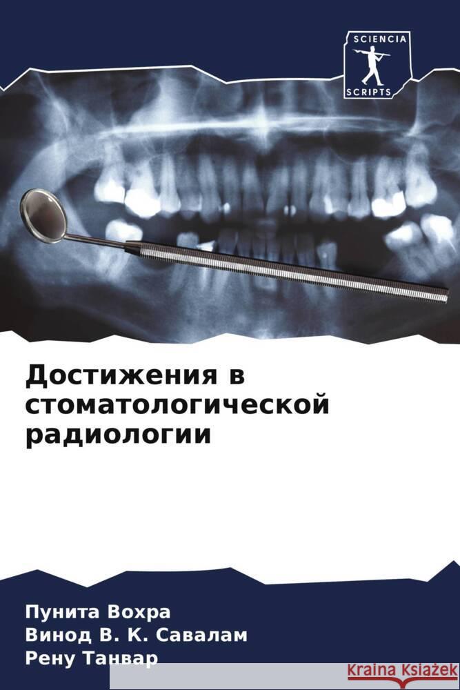 Dostizheniq w stomatologicheskoj radiologii Vohra, Punita, V. K. Sawalam, Vinod, Tanwar, Renu 9786208243654