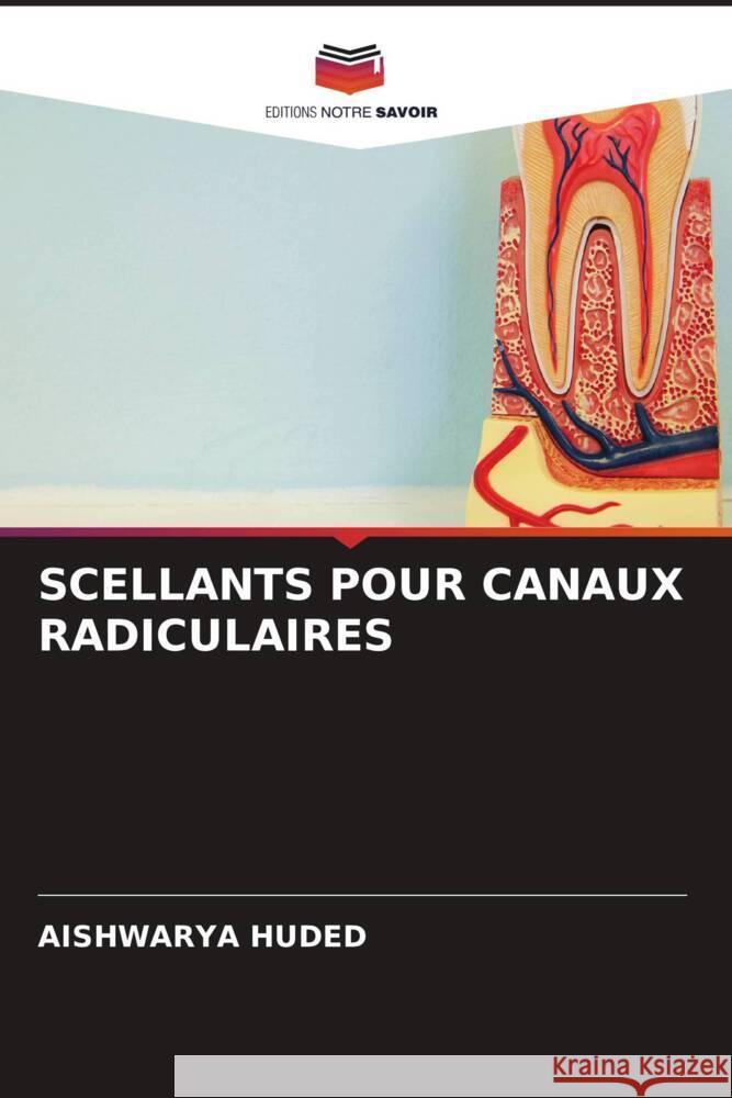 SCELLANTS POUR CANAUX RADICULAIRES HUDED, AISHWARYA 9786208247973