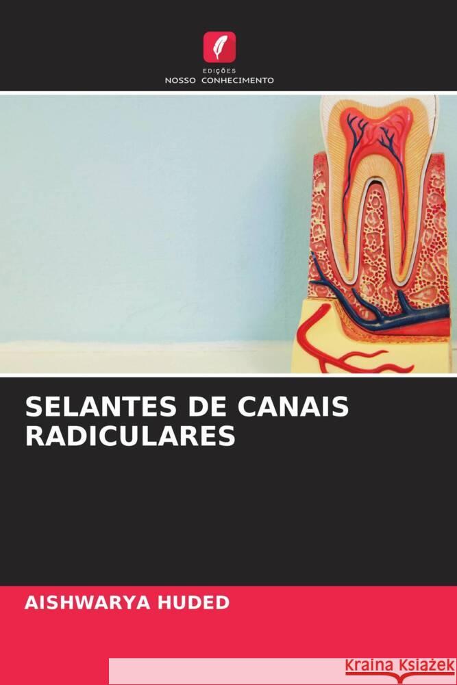 SELANTES DE CANAIS RADICULARES HUDED, AISHWARYA 9786208247997