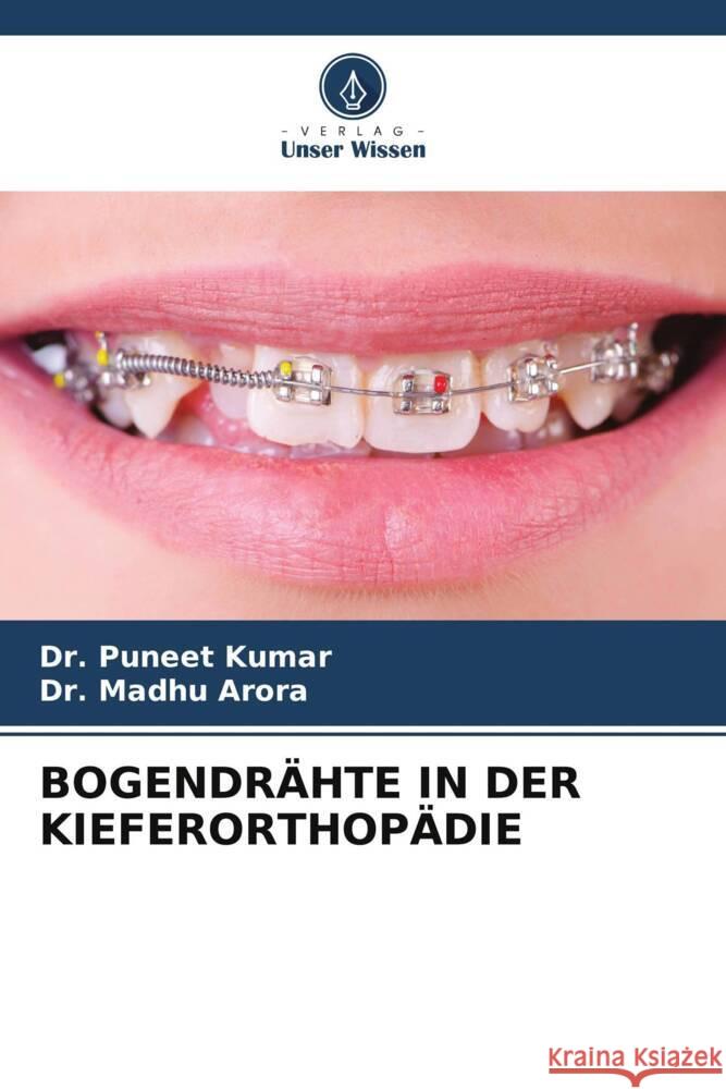 BOGENDRÄHTE IN DER KIEFERORTHOPÄDIE Kumar, Dr. Puneet, Arora, Dr. Madhu 9786208248086