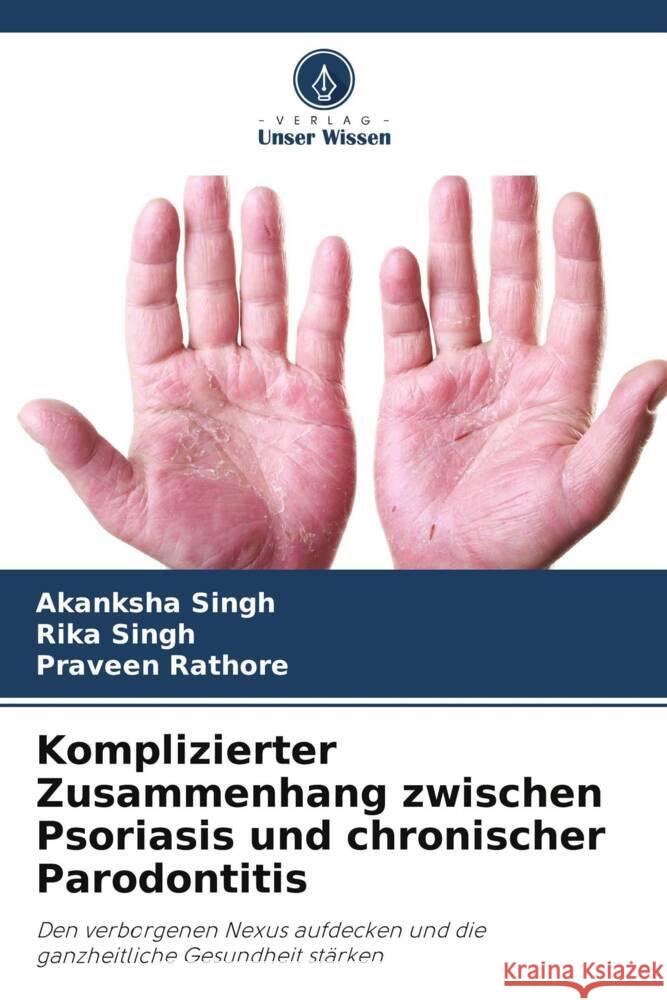 Komplizierter Zusammenhang zwischen Psoriasis und chronischer Parodontitis Singh, Akanksha, Singh, Rika, Rathore, Praveen 9786208249519