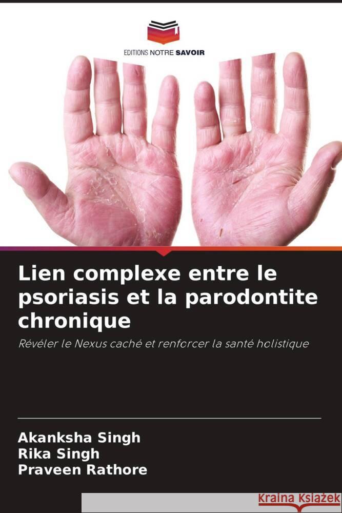 Lien complexe entre le psoriasis et la parodontite chronique Singh, Akanksha, Singh, Rika, Rathore, Praveen 9786208249557