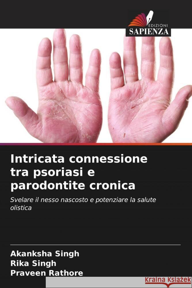 Intricata connessione tra psoriasi e parodontite cronica Singh, Akanksha, Singh, Rika, Rathore, Praveen 9786208249571