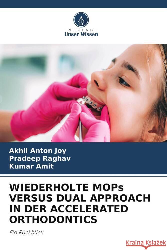 WIEDERHOLTE MOPs VERSUS DUAL APPROACH IN DER ACCELERATED ORTHODONTICS Joy, Akhil Anton, Raghav, Pradeep, Amit, Kumar 9786208249694