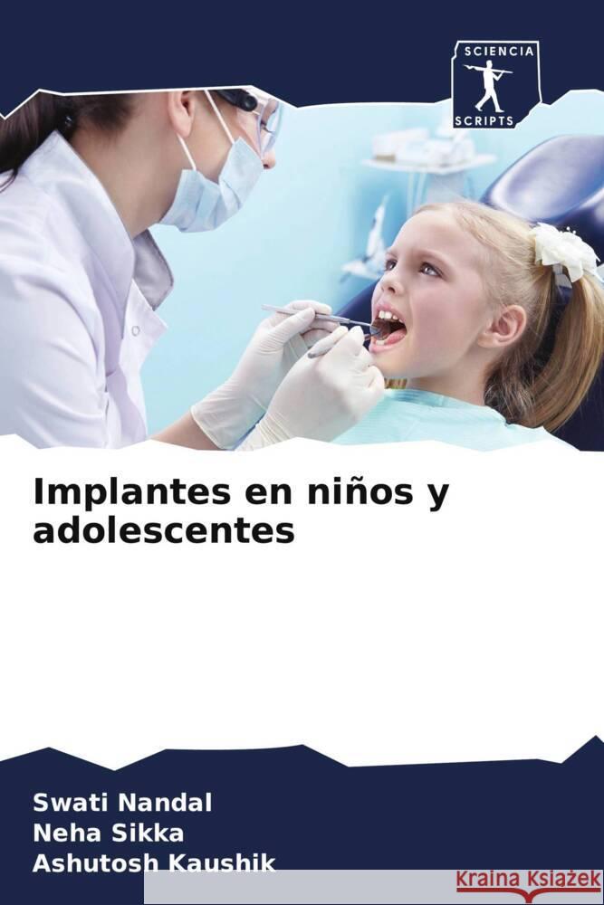 Implantes en niños y adolescentes Nandal, Swati, Sikka, Neha, Kaushik, Ashutosh 9786208250652