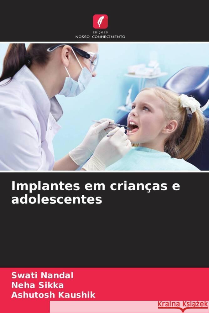 Implantes em crianças e adolescentes Nandal, Swati, Sikka, Neha, Kaushik, Ashutosh 9786208250676