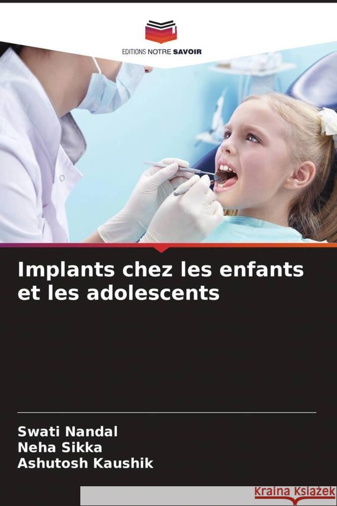 Implants chez les enfants et les adolescents Nandal, Swati, Sikka, Neha, Kaushik, Ashutosh 9786208250690